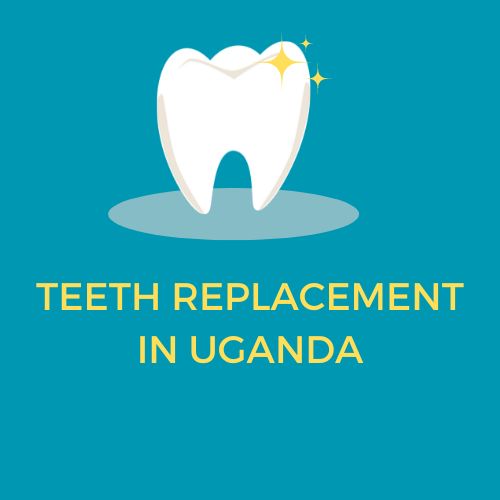 TEETH REPLACEMENT IN UGANDA