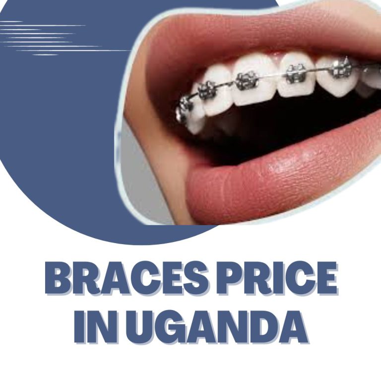 Braces Price in Uganda