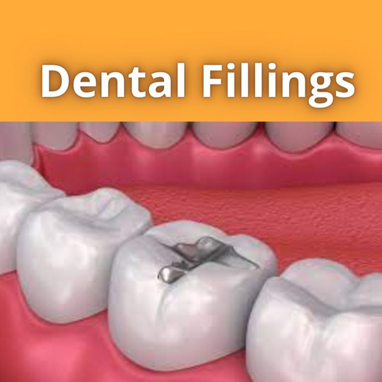 Dental Fillings in Kampala