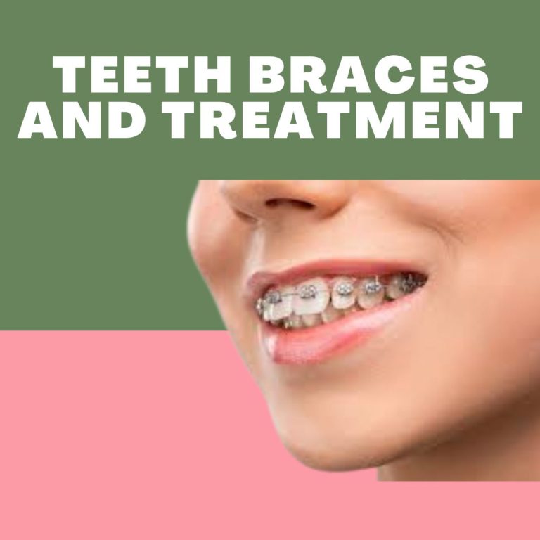 Teeth Braces and Treatment