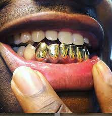 Gold tooth crown, Benefits, Side Effects and cost in Uganda