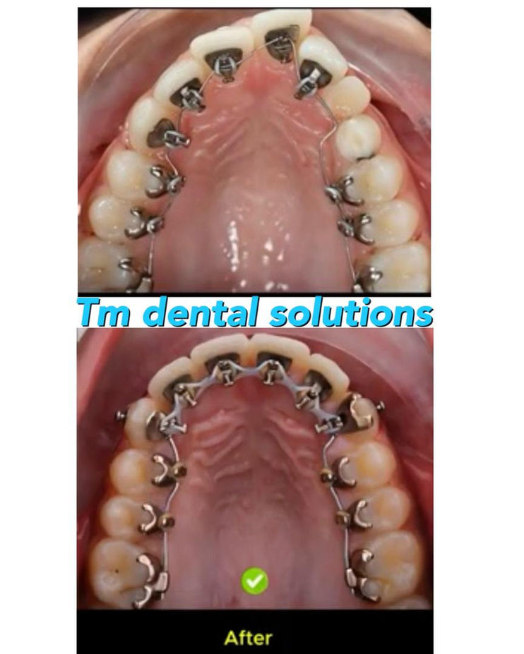 imgi_35_de4112_54165b04cd9a4ed9ad1746ae645ce889~mv2