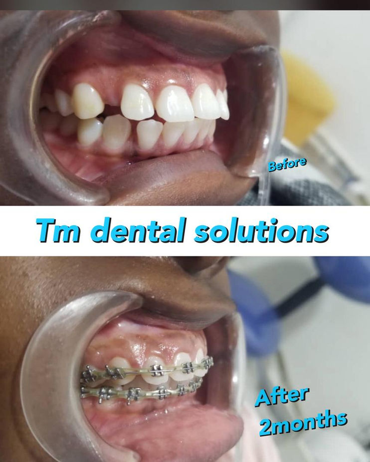 imgi_36_de4112_0efe4a6e9ade4769893ce34ea101d984~mv2